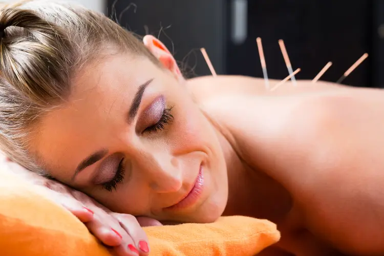 Woman Relaxing During Trigger Point Dry Needling Therapy